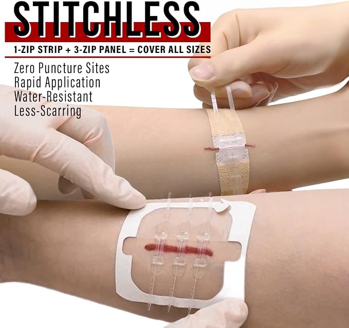 EVERLIT Wound Closure Kit | Surgical Zip-Stitch Devices - Image 3